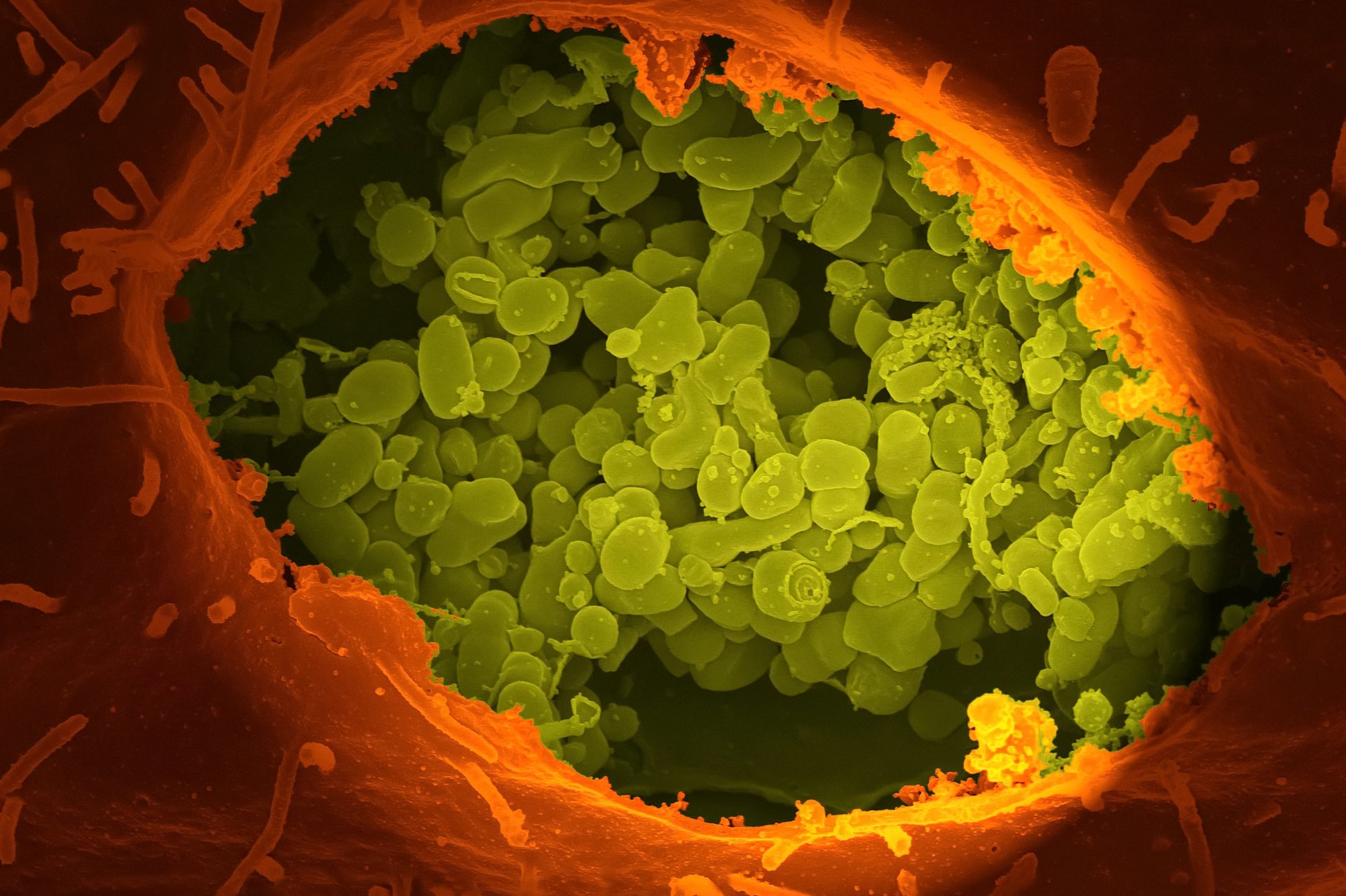 10 неожиданных мест, где могут выживать бактерии: неубиваемые существа