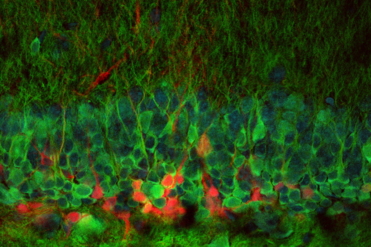 Нервные клетки все-таки восстанавливаются: как отрастают нейроны в мозговой ткани