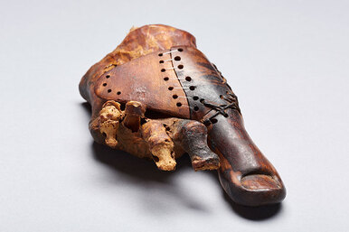 Где был найден самый древний протез
