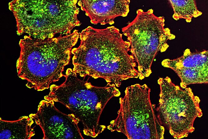 Пребиотики и пробиотики: в чем разница, и что лучше для здоровья