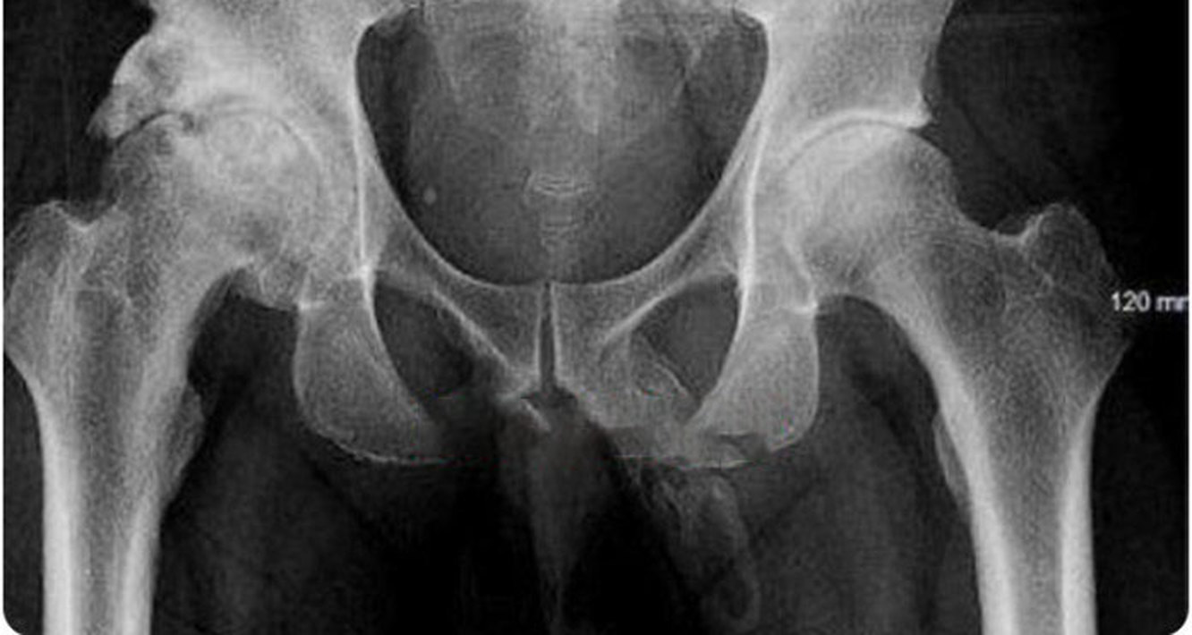 ce penis doctor)