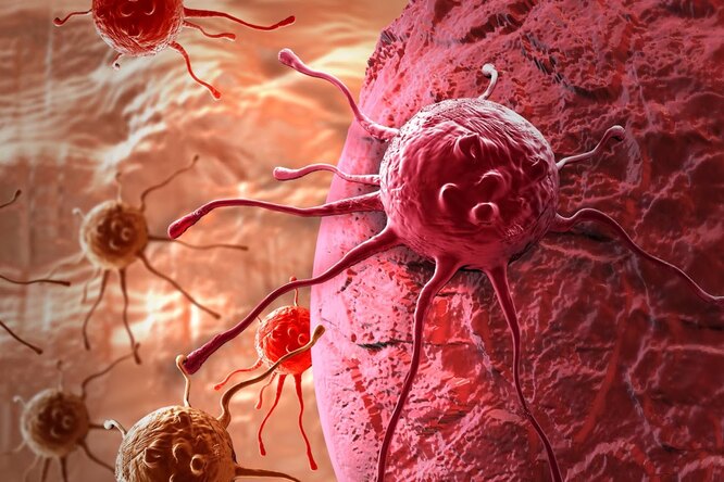 Рак: как им заболевают, почему он так тяжело лечится и существует ли профилактика?