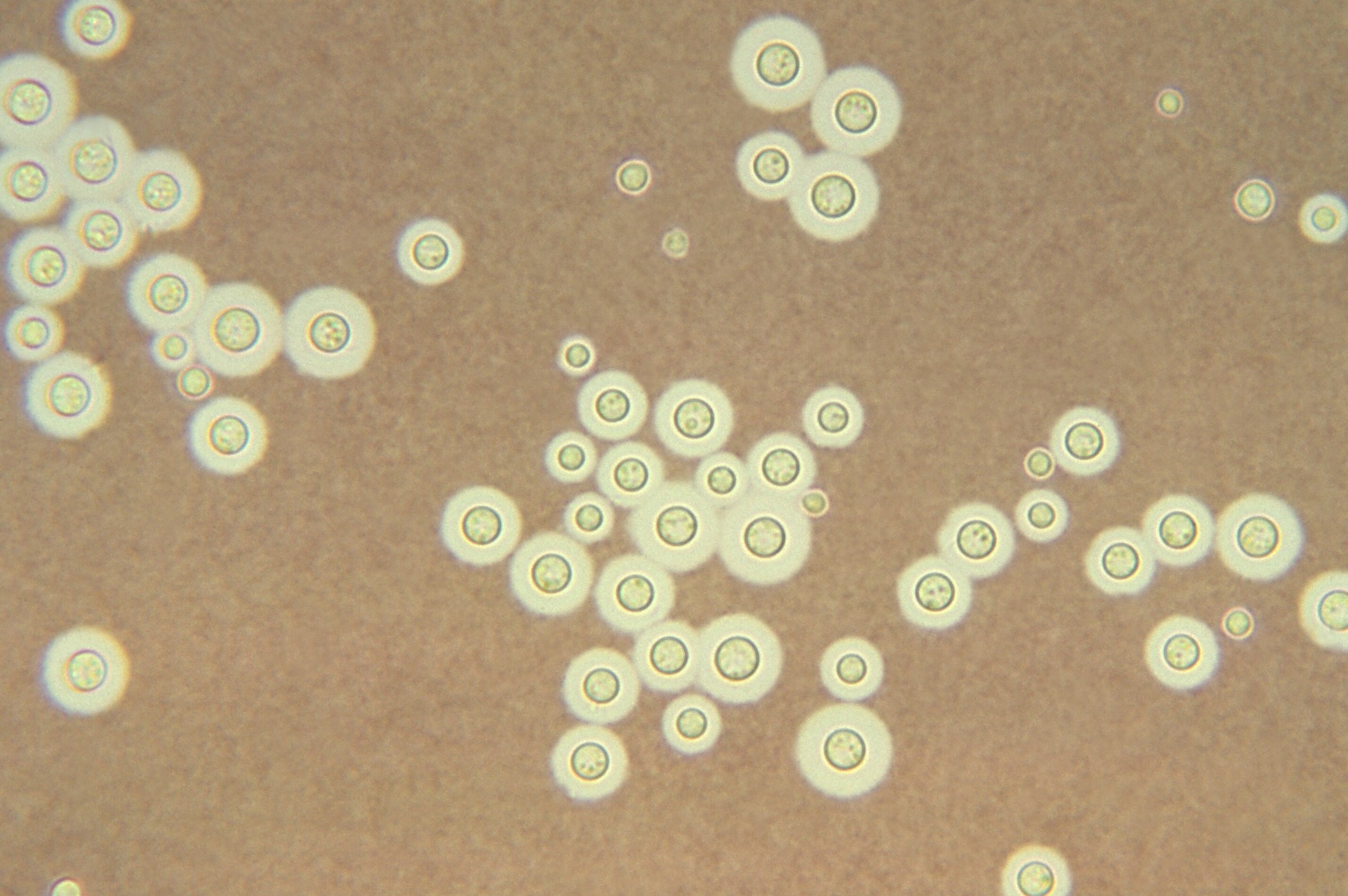 Грибок Cryptococcus neoformans сжимается, чтобы проникнуть в мозг человека