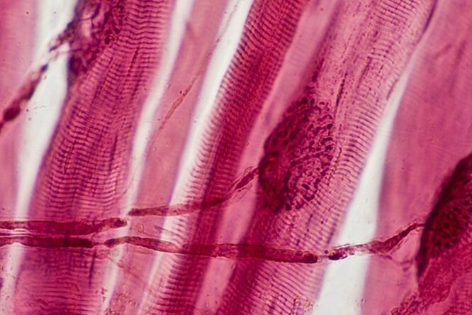 Почему мышцы слабеют с возрастом и можно ли этого избежать