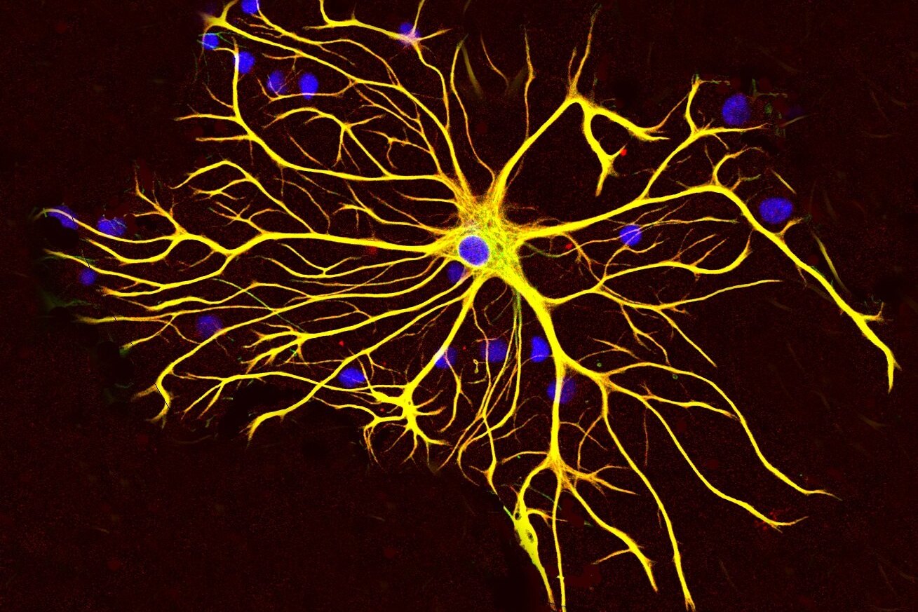 Нейробиологи показали, как из живых нейронов и астроцитов построить искусственную нейросеть